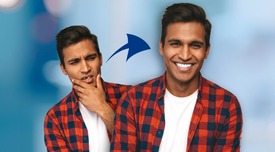 How to Fix Missing Teeth Modern Dental Solutions Explained